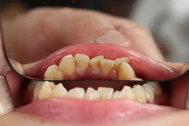 dentist-640x480-30047939.jpeg