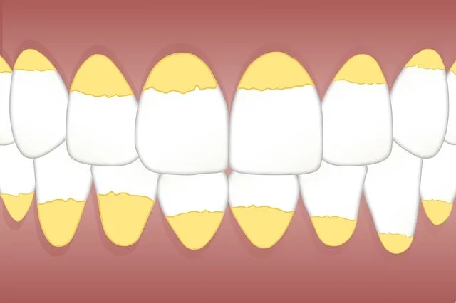 Harlingen Dentist: Modern Orthodontics for Enhanced Facial Aesthetics